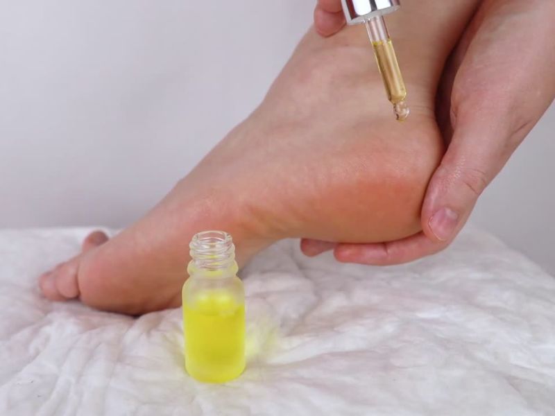 Devojka stavlja ulje na stopala i pete